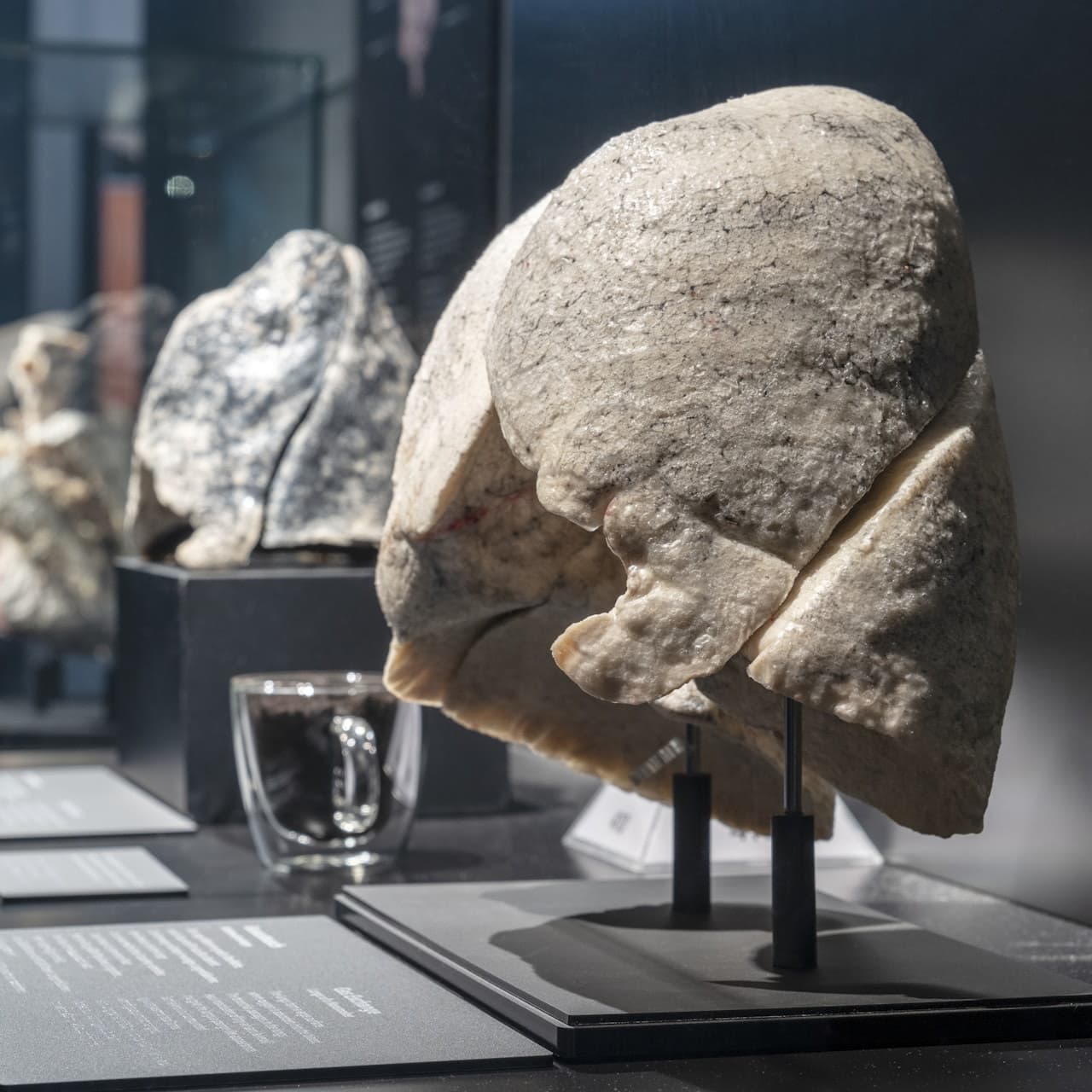 BODY WORLDS Berlin - სურათი 5